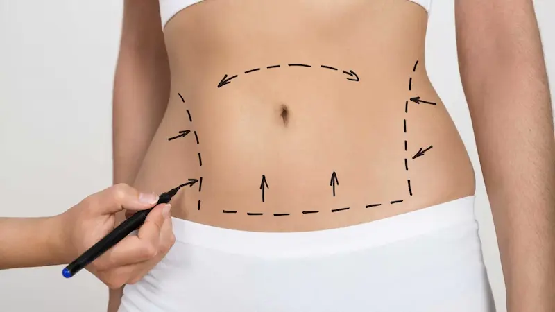Understanding Tummy Tuck Clinical Trials: Opportunities for Advancement and Compensation